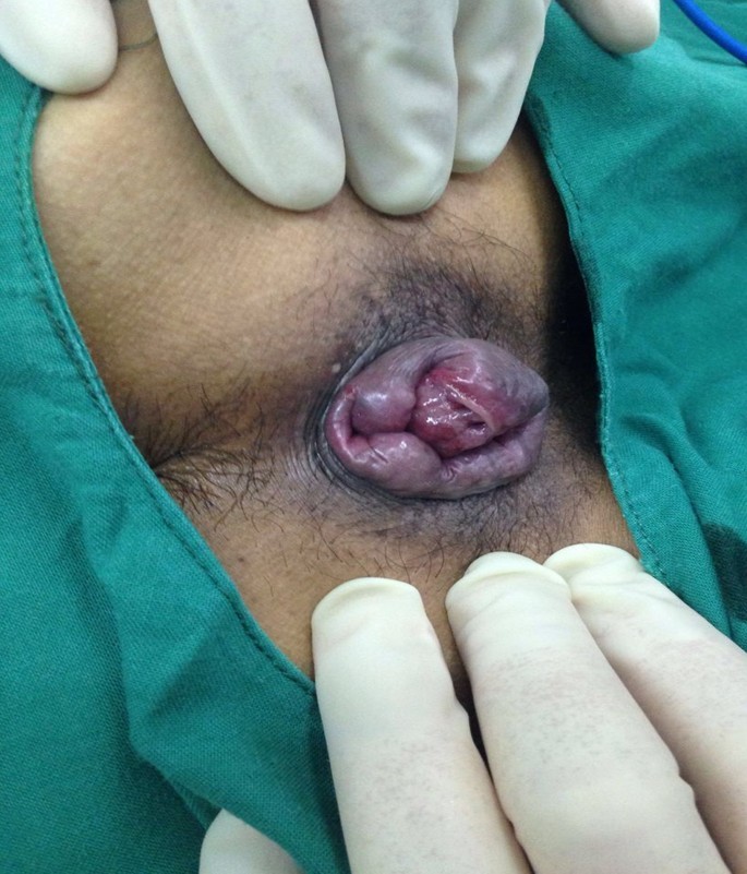 CORE技术 治疗前后效果图